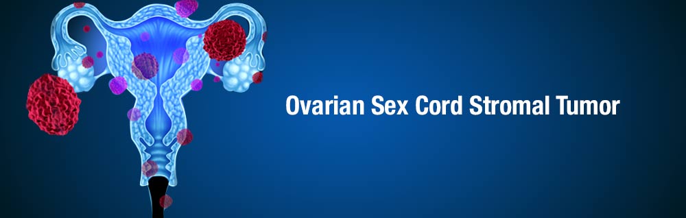 Ovarian Sex Cord Stromal Tumor