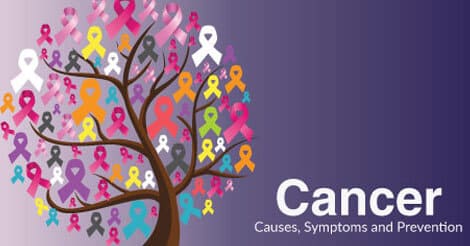 Cancer Causes, Symptoms and Prevention