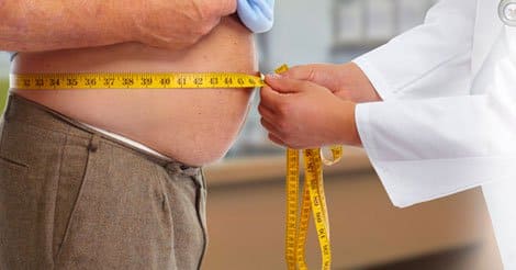 Obesity - Causes, Symptoms, Effects, and Prevention