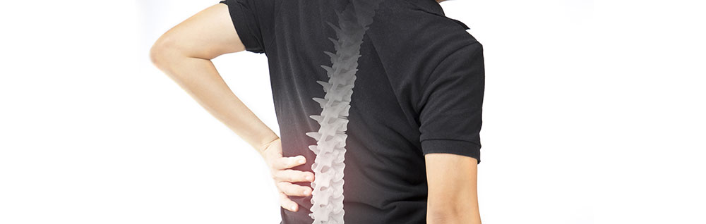 Spinal Fusion Surgery